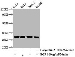 Invitrogen Phospho-HSP27 (Ser82) Recombinant Rabbit Monoclonal Antibody