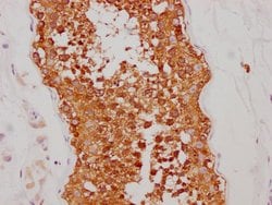 Invitrogen HSP90 alpha Recombinant Rabbit Monoclonal Antibody (4D1) 100