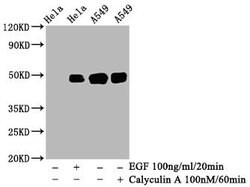 Invitrogen Phospho-c-Jun (Ser63) Recombinant Rabbit Monoclonal Antibody (4A11) 100 &mu;L | Buy Online | Invitrogen&trade; | Fisher Scientific