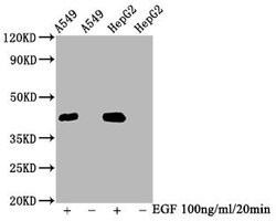 Invitrogen Phospho-ERK1/ERK2 (Thr185, Thr202) Recombinant Rabbit Monoclonal Antibody (2D5) 100 &mu;L | Buy Online | Invitrogen&trade; | Fisher Scientific