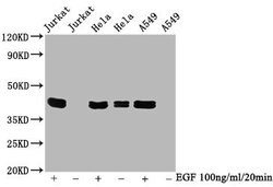 Invitrogen Phospho-ERK1/ERK2 (Thr185, Tyr187, Thr202, Tyr204) Recombinant