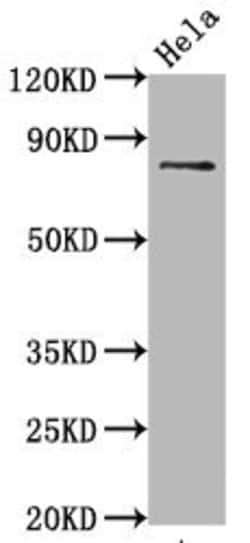 Invitrogen Phospho-Tau (Ser396) Recombinant Rabbit Monoclonal Antibody (1G3) 100 &mu;L | Buy Online | Invitrogen&trade; | Fisher Scientific