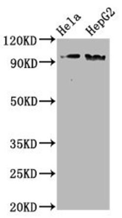 Invitrogen Phospho-NBS1 (Ser343) Recombinant Rabbit Monoclonal Antibody