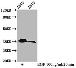 Invitrogen Phospho-PP2A alpha (Tyr307) Recombinant Rabbit Monoclonal Antibody