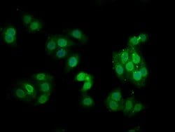Invitrogen Phospho-PKC alpha (Thr638) Recombinant Rabbit Monoclonal Antibody
