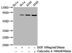 Invitrogen Phospho-PKC alpha (Thr638) Recombinant Rabbit Monoclonal Antibody