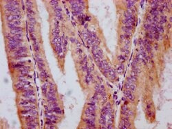 Invitrogen Phospho-c-Raf (Ser259) Recombinant Rabbit Monoclonal Antibody