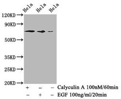 Invitrogen Phospho-c-Raf (Ser259) Recombinant Rabbit Monoclonal Antibody