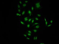 Invitrogen Phospho-c-Raf (Ser621) Recombinant Rabbit Monoclonal Antibody