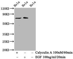 Invitrogen Phospho-c-Raf (Ser621) Recombinant Rabbit Monoclonal Antibody
