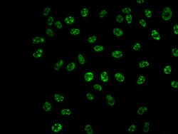 Invitrogen Phospho-p70 S6 Kinase (Thr421, Ser424) Recombinant Rabbit Monoclonal