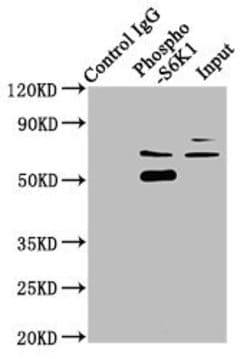 Invitrogen Phospho-p70 S6 Kinase (Thr421, Ser424) Recombinant Rabbit Monoclonal