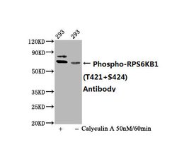 Invitrogen Phospho-p70 S6 Kinase (Thr421, Ser424) Recombinant Rabbit Monoclonal