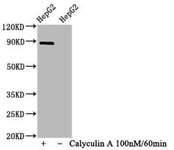 Invitrogen Phospho-STAT1 (Ser727) Recombinant Rabbit Monoclonal Antibody (2H10) 100 &mu;L | Buy Online | Invitrogen&trade; | Fisher Scientific
