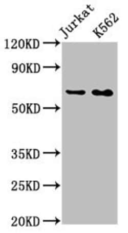 Invitrogen STIP1 Recombinant Rabbit Monoclonal Antibody (3E4) 100 &mu;L;