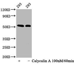 Invitrogen Phospho-p53 (Ser392) Recombinant Rabbit Monoclonal Antibody