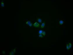 Invitrogen TSPO Recombinant Rabbit Monoclonal Antibody (23G2) 100 &mu;L | Buy Online | Invitrogen&trade; | Fisher Scientific