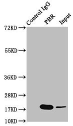 Invitrogen TSPO Recombinant Rabbit Monoclonal Antibody (23G2) 100 &mu;L | Buy Online | Invitrogen&trade; | Fisher Scientific