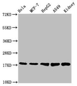 Invitrogen TSPO Recombinant Rabbit Monoclonal Antibody (23G2) 100 &mu;L | Buy Online | Invitrogen&trade; | Fisher Scientific