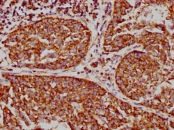 Invitrogen VDAC Recombinant Rabbit Monoclonal Antibody (3A1) 100 &mu;L;