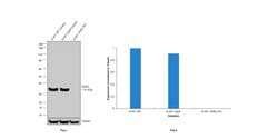 Invitrogen VDAC Recombinant Rabbit Monoclonal Antibody (3A1) 100 &mu;L;