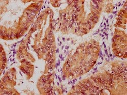 Invitrogen Phospho-YAP1 (Ser127) Recombinant Rabbit Monoclonal Antibody
