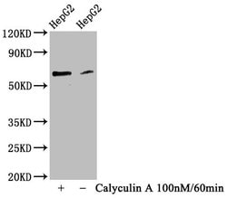 Invitrogen Phospho-YAP1 (Ser127) Recombinant Rabbit Monoclonal Antibody