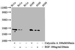 Phospho-CDK1/CDK2/CDK3 (Thr14) Recombinant Rabbit Monoclonal Antibody (4C12),