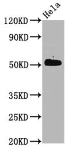 Invitrogen Phospho-CDC37 (Ser13) Recombinant Rabbit Monoclonal Antibody