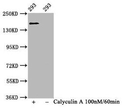 Invitrogen Phospho-SMC1 (Ser957) Recombinant Rabbit Monoclonal Antibody