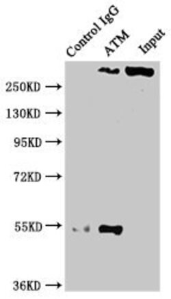 Invitrogen ATM Recombinant Rabbit Monoclonal Antibody (4E11) 100 &mu;L;