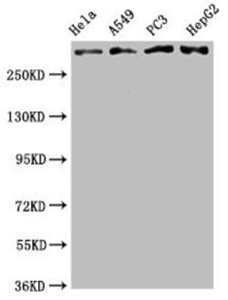 Invitrogen ATM Recombinant Rabbit Monoclonal Antibody (4E11) 100 &mu;L;