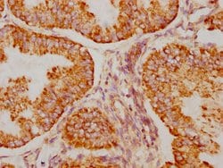 Invitrogen BAK Recombinant Rabbit Monoclonal Antibody (8D1) 100 &mu;L;