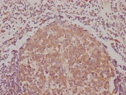 Invitrogen BAK Recombinant Rabbit Monoclonal Antibody (8D1) 100 &mu;L;