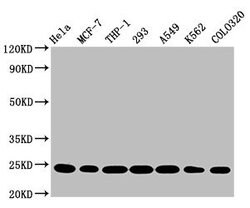 Invitrogen BAK Recombinant Rabbit Monoclonal Antibody (8D1) 100 &mu;L;