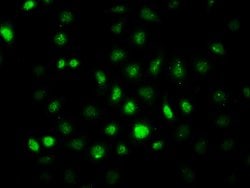 Invitrogen Phospho-AMPK alpha-2 (Thr172) Recombinant Rabbit Monoclonal