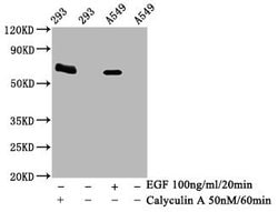 Invitrogen Phospho-AMPK alpha-2 (Thr172) Recombinant Rabbit Monoclonal