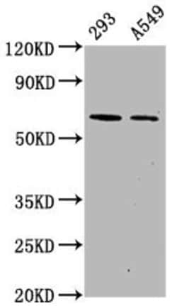 Invitrogen Phospho-AMPK alpha-2 (Ser491) Recombinant Rabbit Monoclonal Antibody (3H10) 100 &mu;L | Buy Online | Invitrogen&trade; | Fisher Scientific