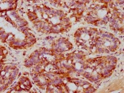 Invitrogen NDRG1 Recombinant Rabbit Monoclonal Antibody (4C8) 100 &mu;L;