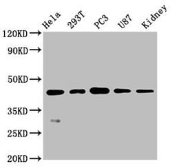 Invitrogen NDRG1 Recombinant Rabbit Monoclonal Antibody (4C8) 100 &mu;L;