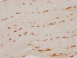 Invitrogen FTO Recombinant Rabbit Monoclonal Antibody (4G9) 100 &mu;L;