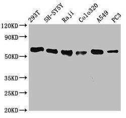 Invitrogen FTO Recombinant Rabbit Monoclonal Antibody (4G9) 100 &mu;L;