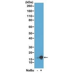 Invitrogen H3K9ac Recombinant Rabbit Monoclonal Antibody (RM161), ChIP-Verified 100 &mu;g | Buy Online | Invitrogen&trade; | Fisher Scientific