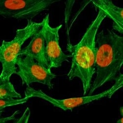 Invitrogen H3K9me1 Recombinant Rabbit Monoclonal Antibody (RM150), ChIP-Verified:Antibodies:Primary