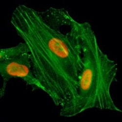 Invitrogen H4K8ac Recombinant Rabbit Monoclonal Antibody (RM201), ChIP-Verified:Antibodies:Primary