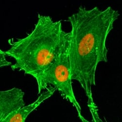 Invitrogen H4K20ac Recombinant Rabbit Monoclonal Antibody (RM205), ChIP-Verified