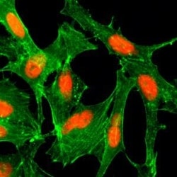 Invitrogen H4K12ac Recombinant Rabbit Monoclonal Antibody (RM202), ChIP-Verified
