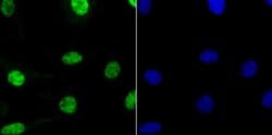Invitrogen RbAp48 Recombinant Rabbit Monoclonal Antibody (JU37-47) 100