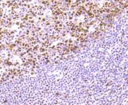 Invitrogen RbAp48 Recombinant Rabbit Monoclonal Antibody (JU37-47) 100