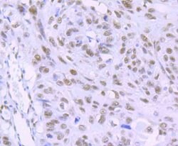 Invitrogen RbAp48 Recombinant Rabbit Monoclonal Antibody (JU37-47) 100